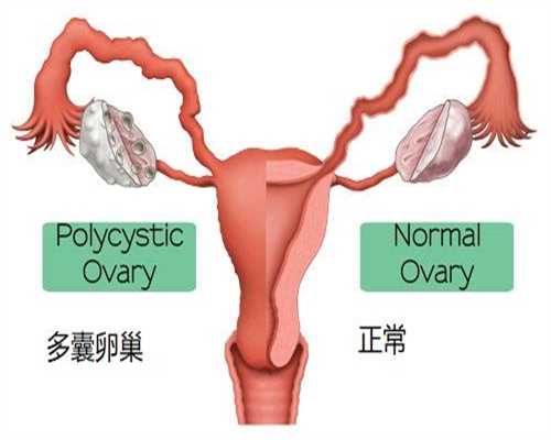 温州代孕多少钱：豆浆、四物汤养大子宫肌瘤中