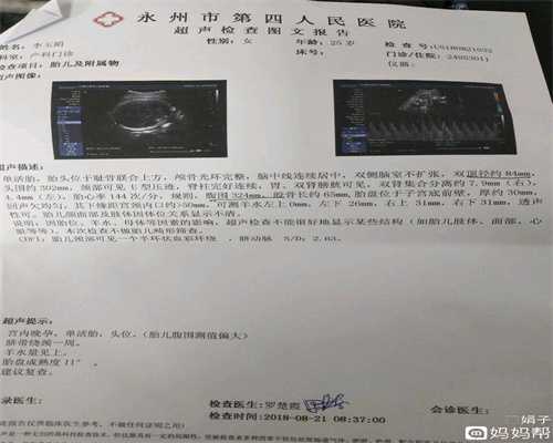 八成以上杭州代孕缺乏维生素D　真的吗？