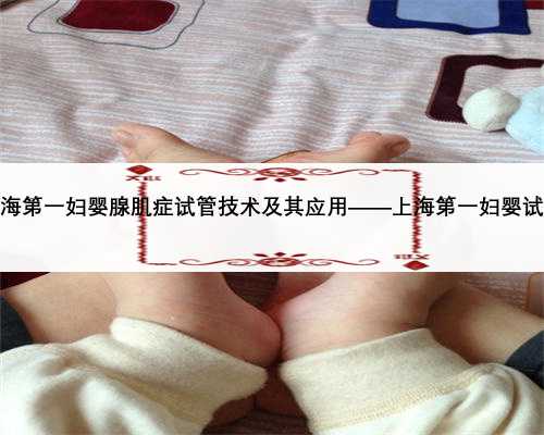 上海第一妇婴腺肌症试管技术及其应用——上海第一妇婴试管